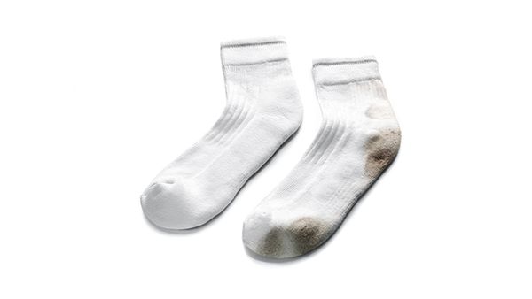 stained white socks